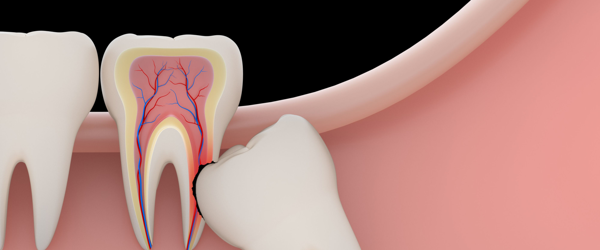 What are Bicuspid Teeth and How Do They Differ from Other Teeth?