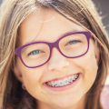 Why Bicuspids Play An Important Role In Braces Treatment In London