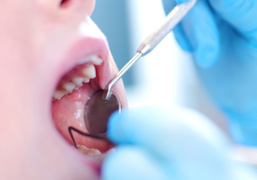 Preventing Milk Tooth Decay in Children: A Guide for Parents