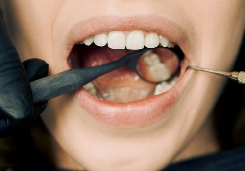 Beyond Brushing: How Edmonds Dentists Can Ensure Optimal Bicuspids Health