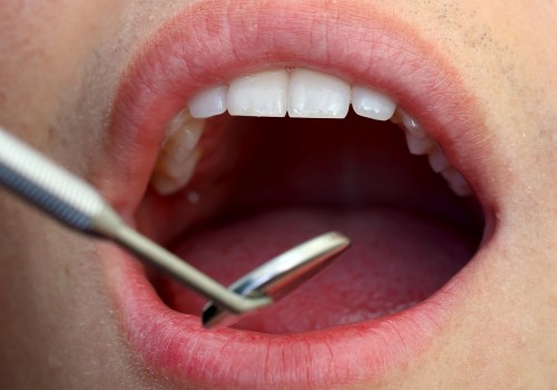 What Foods Should Not Be Chewed With a Bicuspid Tooth?