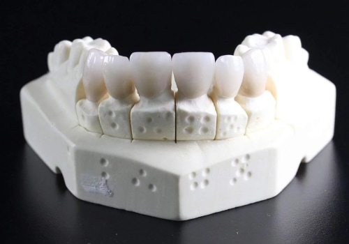 What is the Difference Between Primary and Permanent Molars Roots?